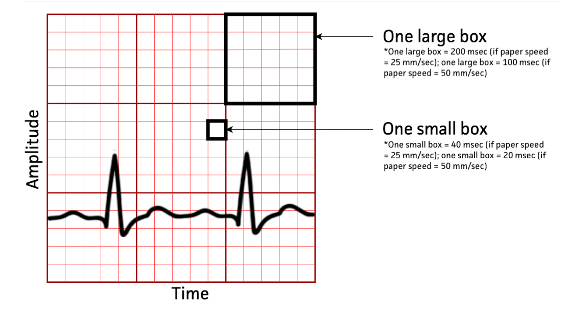 ECG paper reference showing one large box equals 200 msec at 25 mm/sec or 100 msec at 50 mm/sec, and one small box equals 40 msec at 25 mm/sec or 20 msec at 50 mm/sec.
